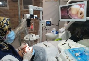 راه اندازی نخستین میکروسکوپ سه بعدی دندان در نیشابور راه اندازی نخستین میکروسکوپ سه بعدی دندان در نیشابور