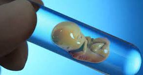 سهم کودک حاصل از لقاح مصنوعی از ارث چیست؟ سهم کودک حاصل از لقاح مصنوعی از ارث چیست؟