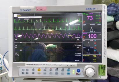 بیمارستان قمر بنی هاشم(ع) به دستگاه پیشرفته مانیتورینگ اتاق عمل مجهز شد بیمارستان قمر بنی هاشم(ع) به دستگاه پیشرفته مانیتورینگ اتاق عمل مجهز شد