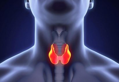 نقش تغذیه در اختلالات تیروئیدی نقش تغذیه در اختلالات تیروئیدی