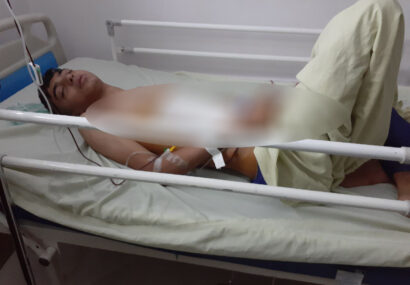 نوجوان نیشابوری بر اثر ضربوشتم کلیهاش را از دست داد نوجوان نیشابوری بر اثر ضربوشتم کلیهاش را از دست داد