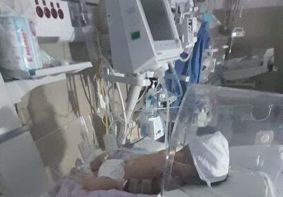 شکسته شدن دست نوزاد در حین زایمان در بیمارستان حکیم شکسته شدن دست نوزاد در حین زایمان در بیمارستان حکیم