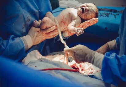 روایت زنان نیشابور از دو راهی زایمان طبیعی و سزارین روایت زنان نیشابور از دو راهی زایمان طبیعی و سزارین